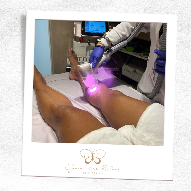 Estética corporal em Araçariguama na Clínica Jacqueline Milani Espaço Estético, referência em tratamentos personalizados.