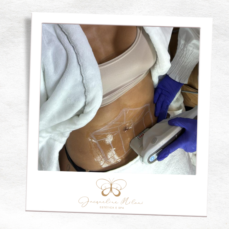 Estética corporal em Araçariguama na Clínica Jacqueline Milani Espaço Estético, referência em tratamentos personalizados.
