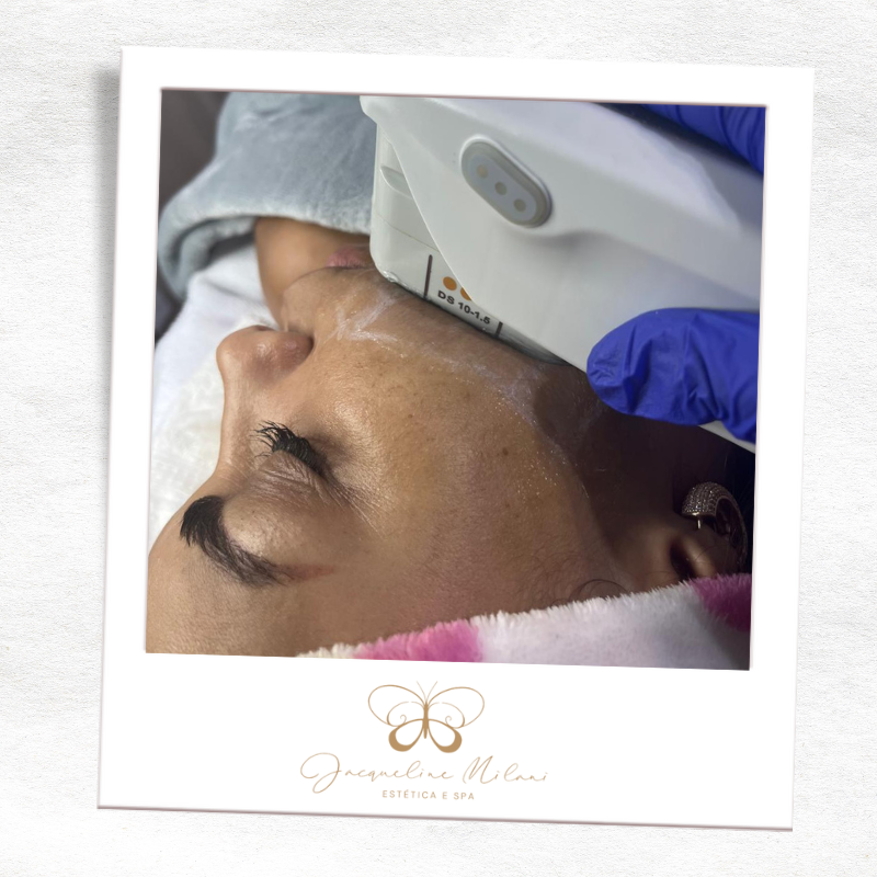 Estética facial em Araçariguama na Clínica Jacqueline Milani Espaço Estético, com protocolos personalizados para rejuvenescimento.