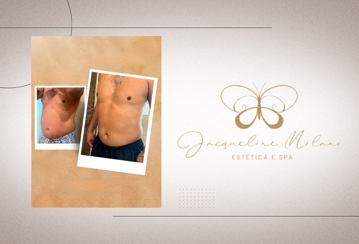 Método Você + no Jacqueline Milani Espaço Estético, referência em estética facial, estética corporal e spa em Araçariguama.