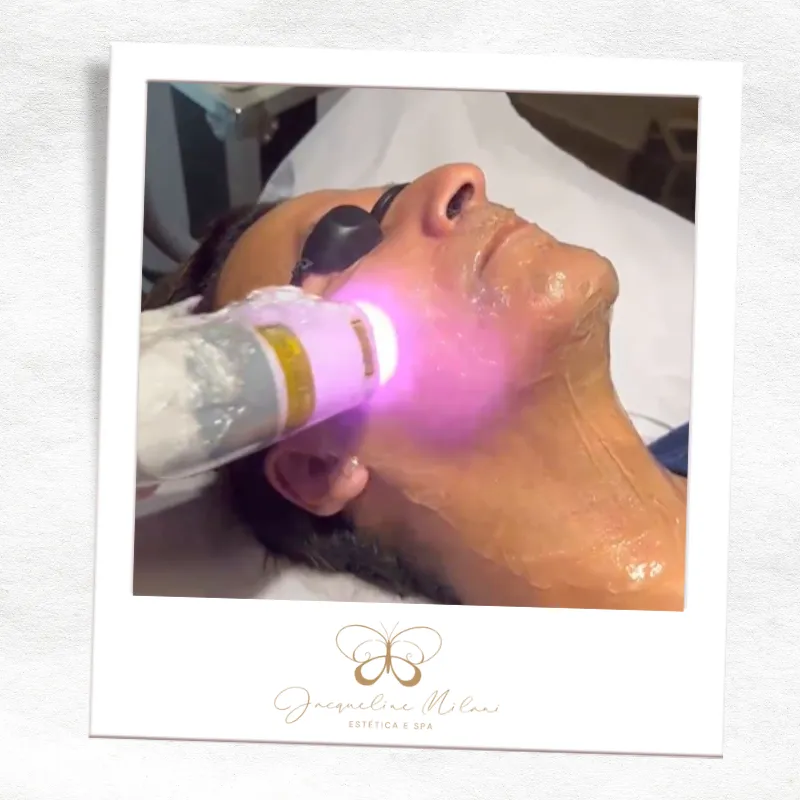 Depilação a laser em Araçariguama SP - Jacqueline Milani