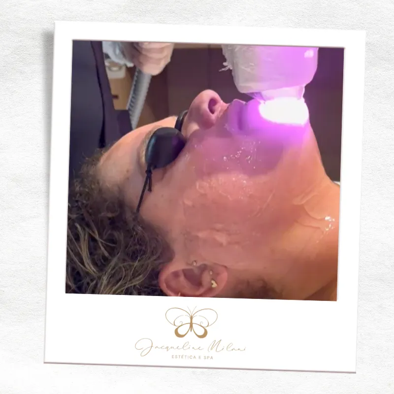 Depilação a laser em Araçariguama SP - Jacqueline Milani